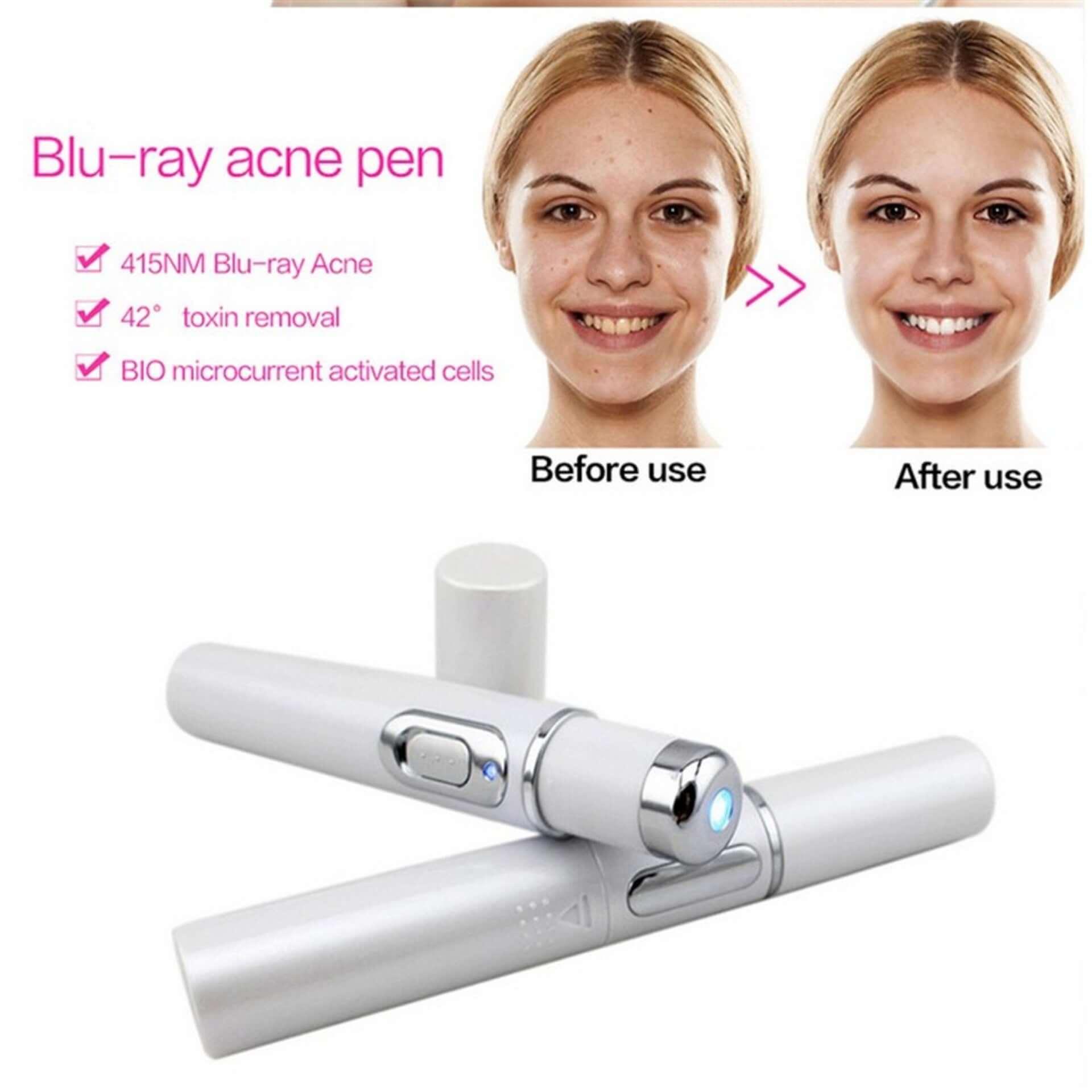 Blue Light Therapy Acne Laser Pen - hairandbeauty