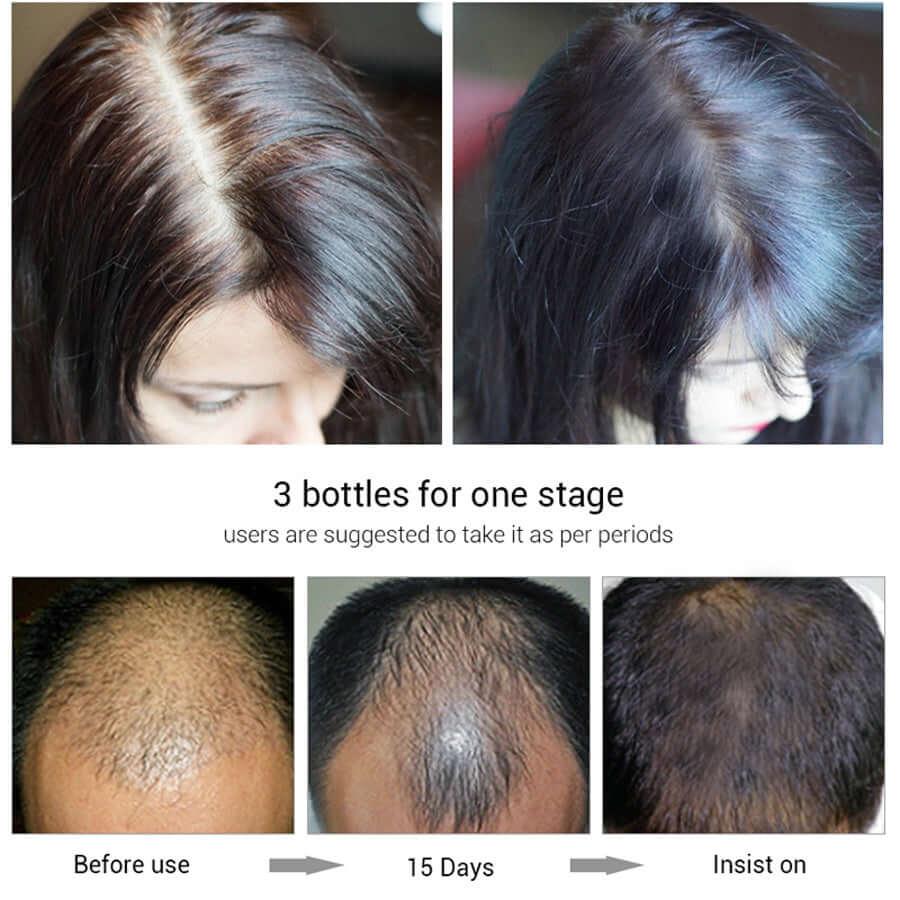 Efero hair growth fluid for natural hair restore or growth - hairandbeauty