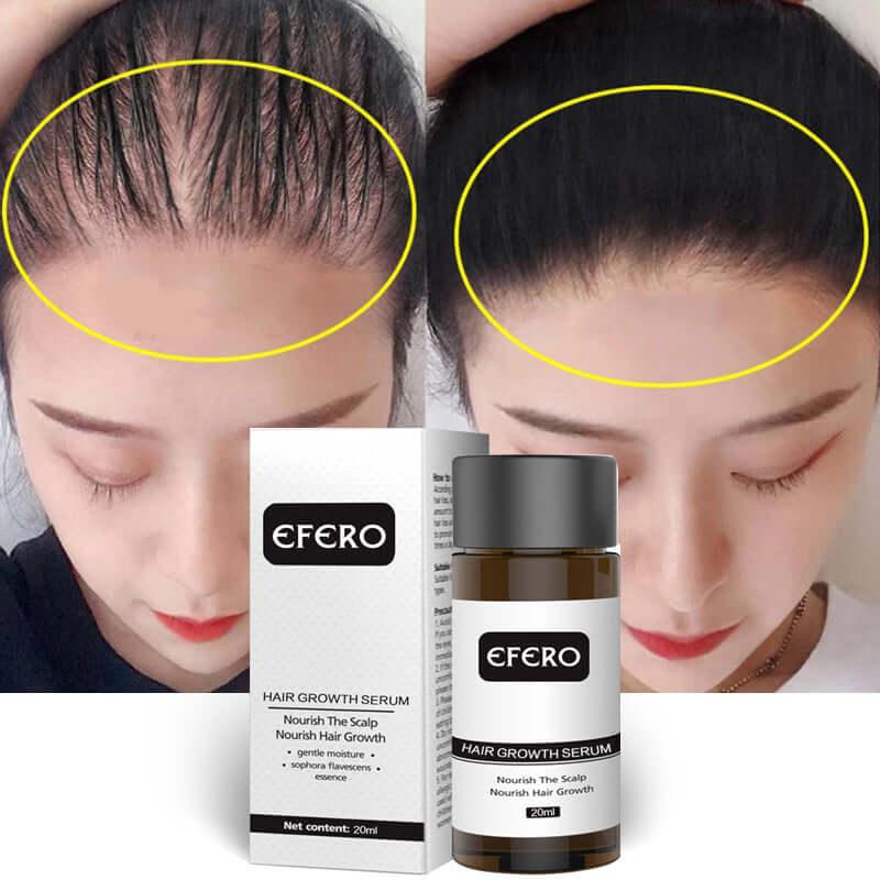 Efero hair growth fluid for natural hair restore or growth - hairandbeauty