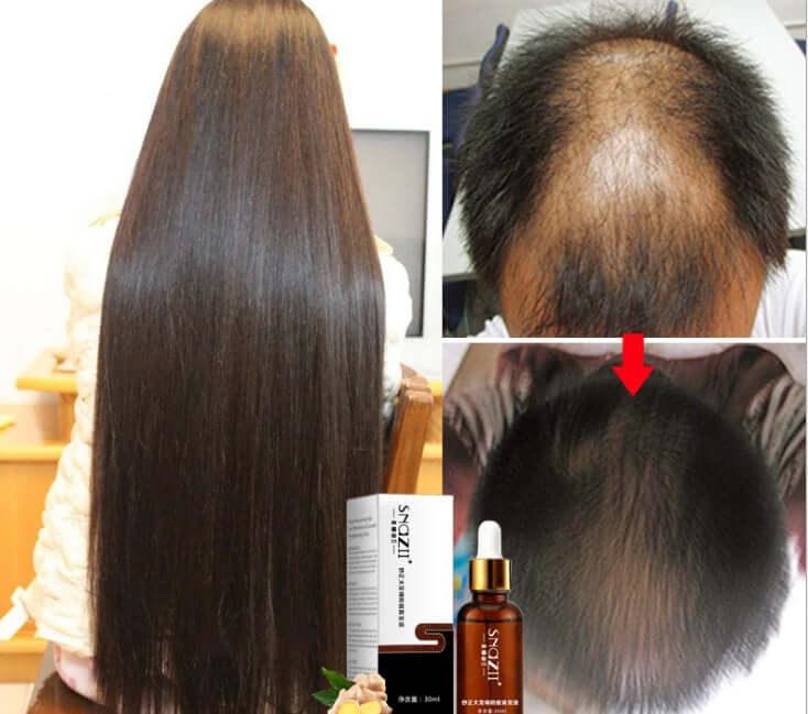 Senna Hair Growth Fluid for hair loss to restore hair - hairandbeauty