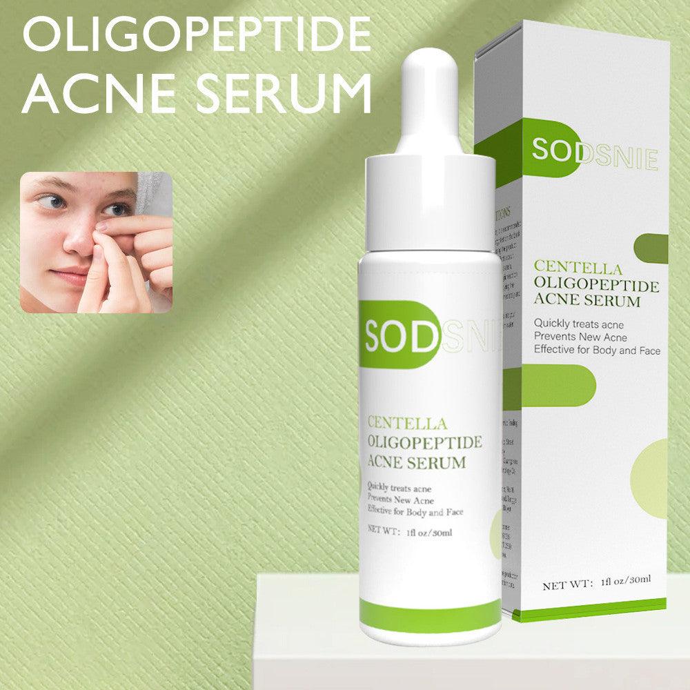 SODSNIE CENTELLA OLIGOPEPTIDE ACNE SERUM 30ml - hairandbeauty