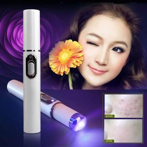 Blue Light Therapy Acne Laser Pen - hairandbeauty