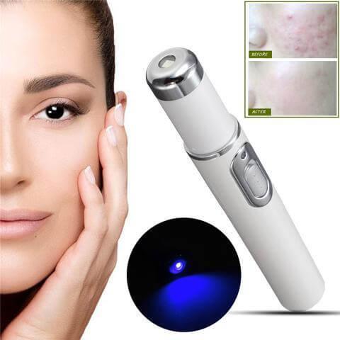 Blue Light Therapy Acne Laser Pen - hairandbeauty