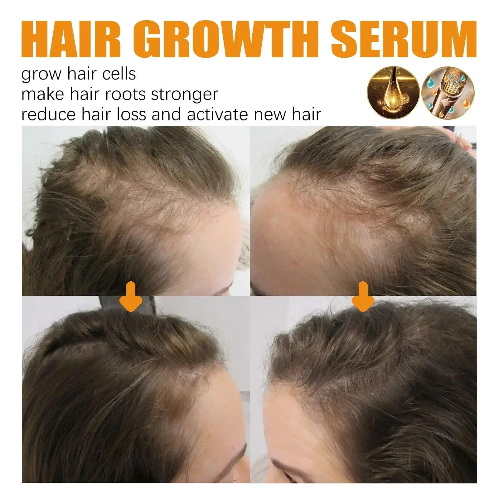 Biotin Fast Hair Growth Products Anti Hair Loss Serum - hairandbeauty