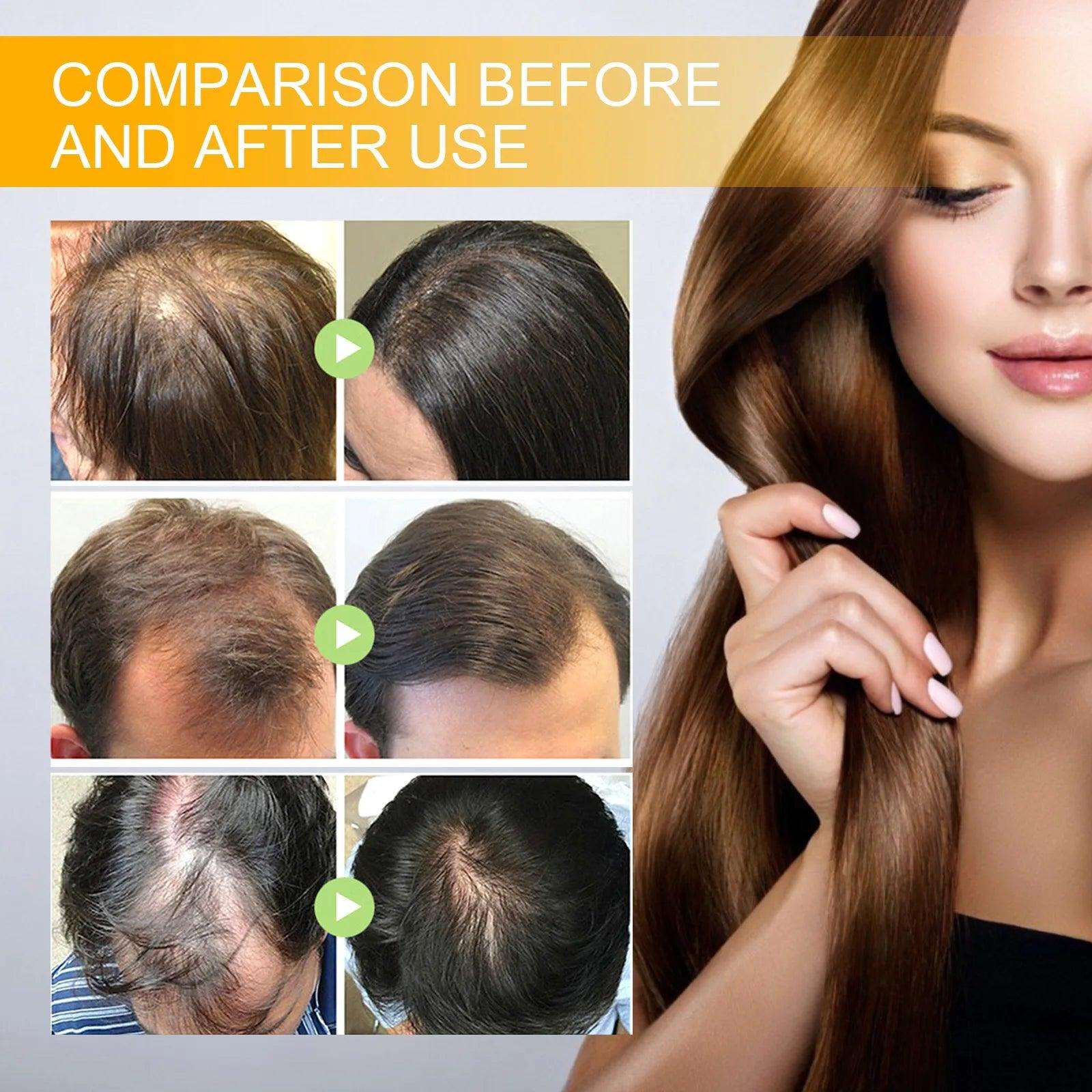 Biotin Hair Growth Spray Anti Dandruff Itching Treatment - hairandbeauty