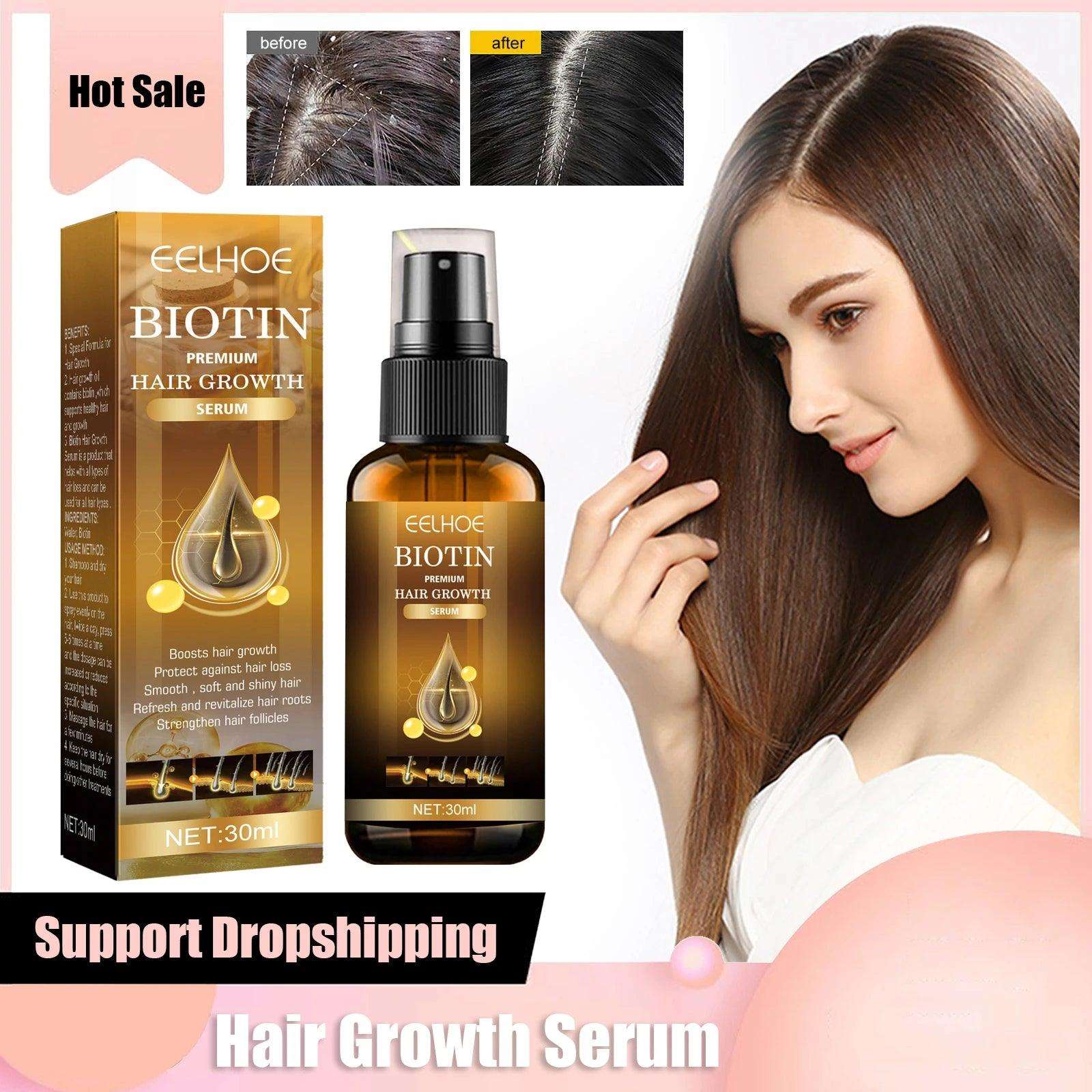 Biotin Hair Growth Spray Anti Dandruff Itching Treatment - hairandbeauty